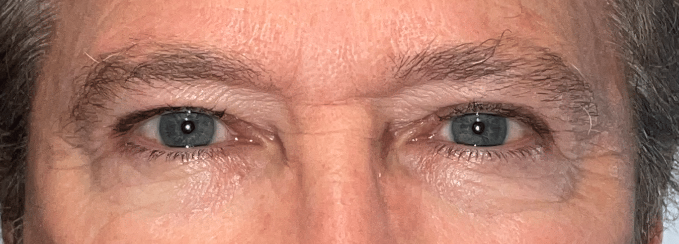 After image