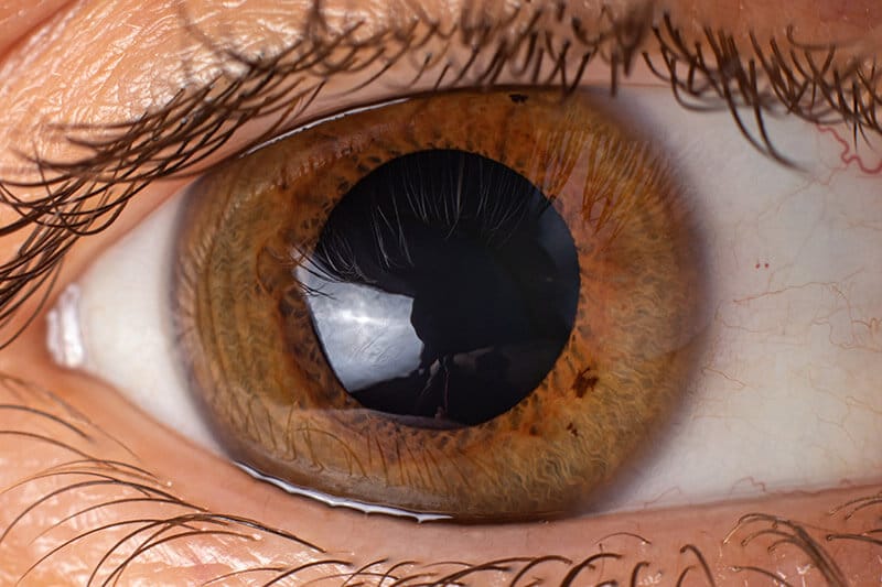 Closeup of an Eye